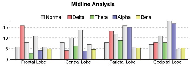 Comparative Midline Analysis